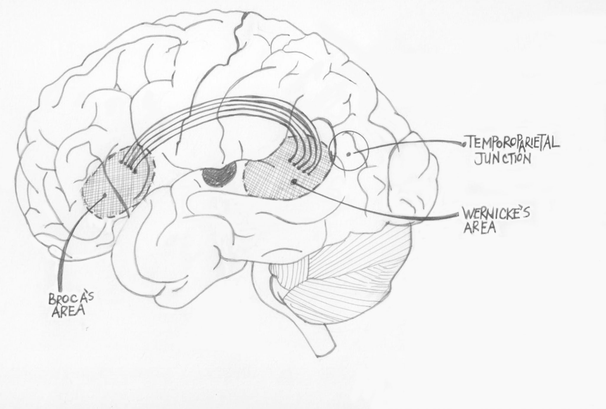 Diagram of the brain showing Broca's area, Wernicke's area and the temporoparietal junction.